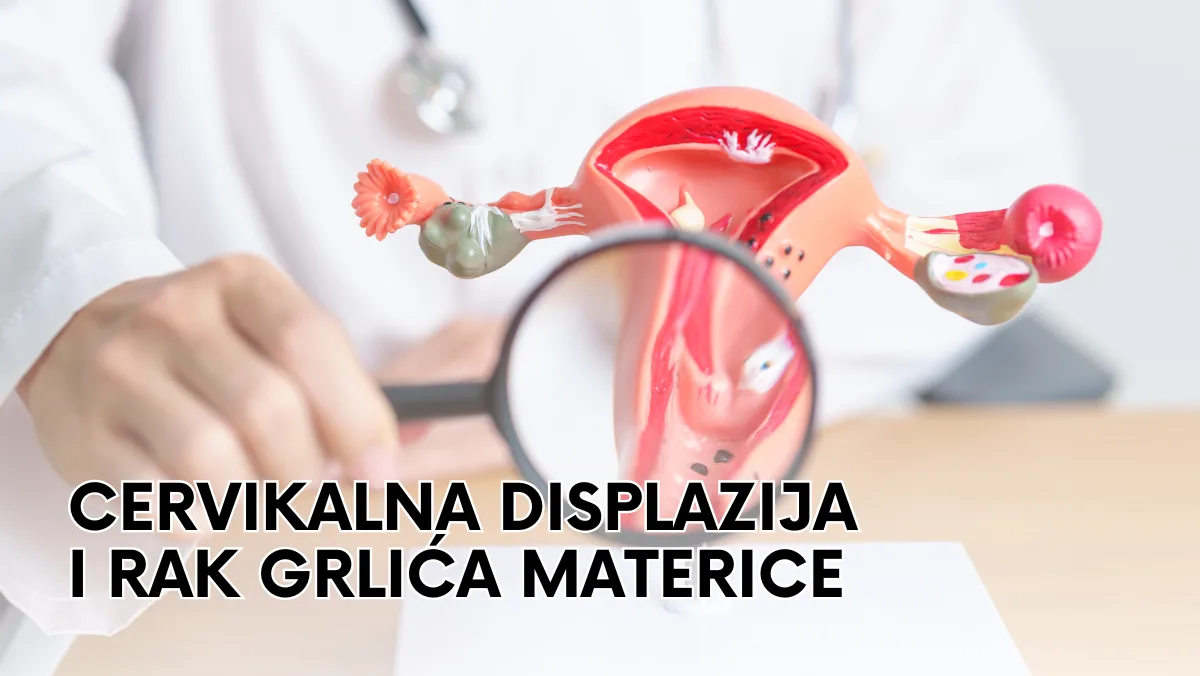Cervikalna displazija i rak grlića materice