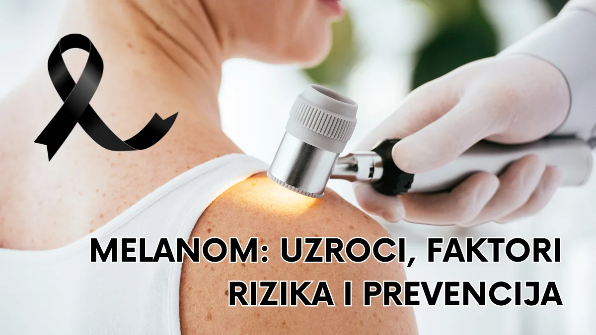 Melanom: uzroci, faktori rizika i prevencija