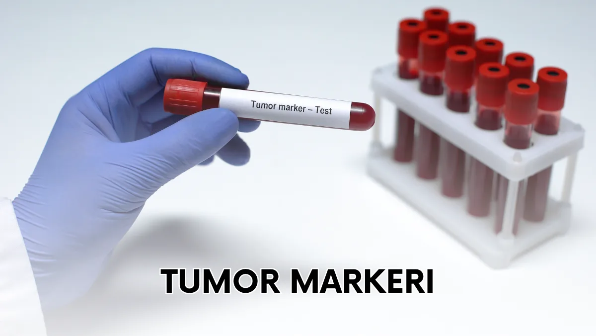 Tumor markeri