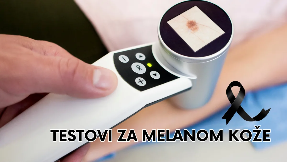 Testovi za melanom kože