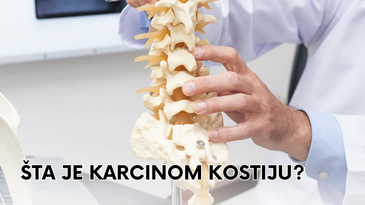 Šta je karcinom kostiju?