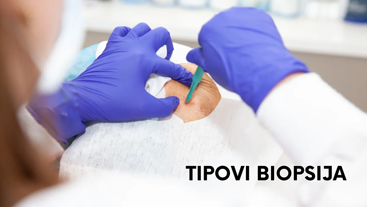 Tipovi biopsija