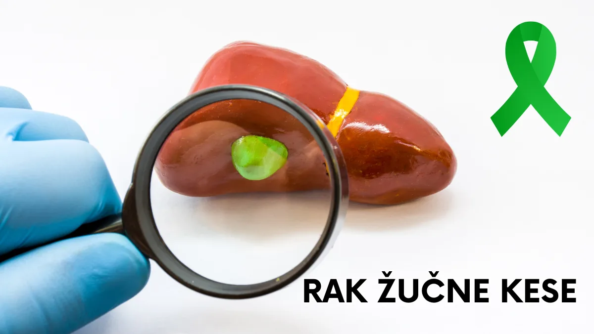 Rak žučne kese