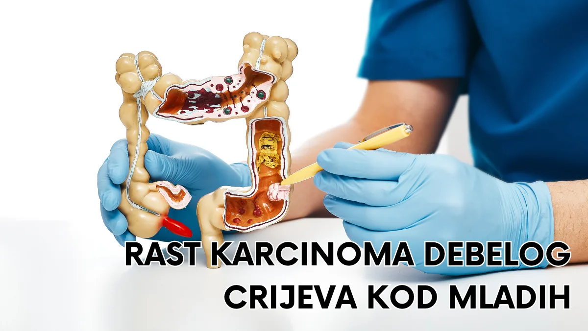 Rast karcinoma debelog crijeva kod mladih
