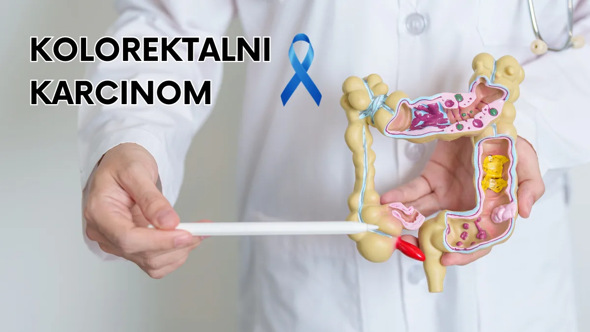 Kolorektalni karcinom