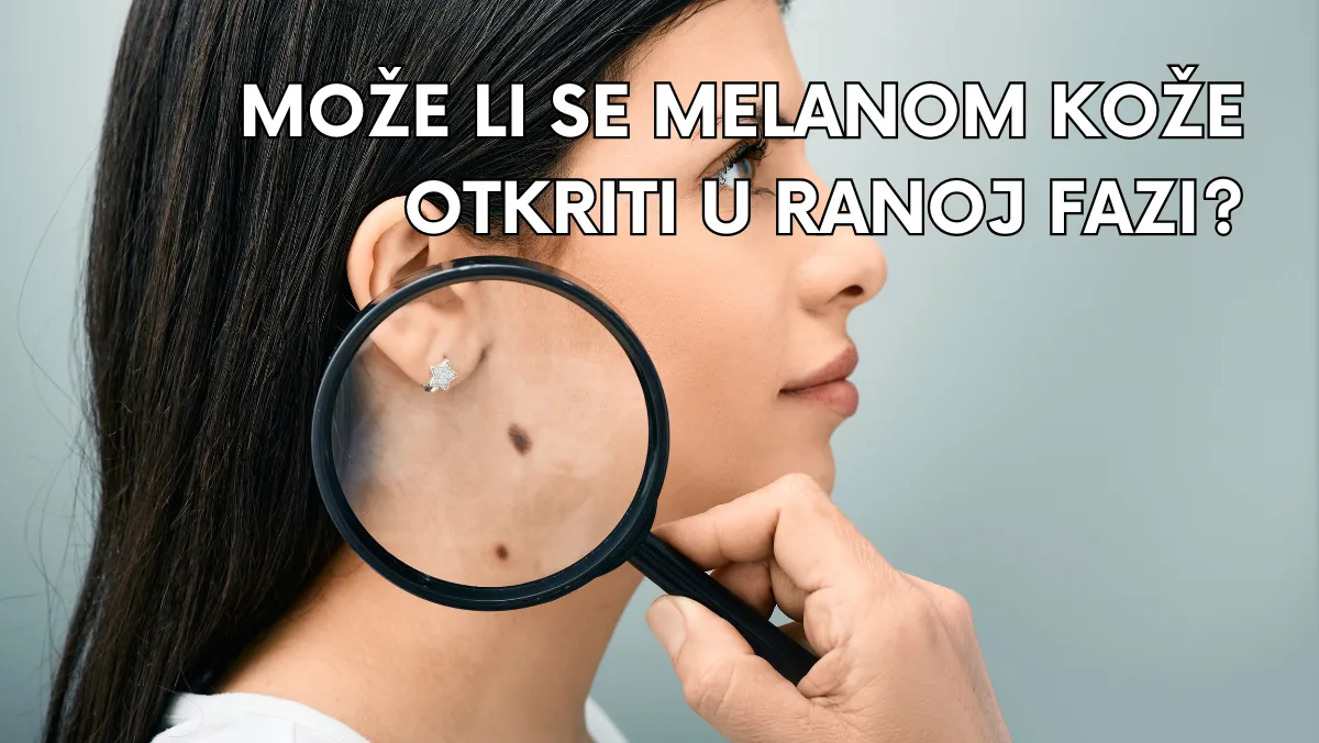 Može li se melanom kože otkriti u ranoj fazi?